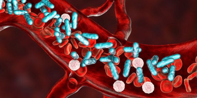 Jedan ćete teško uočiti: Tri manje poznata simptoma sepse na koja ne obraćamo pažnju